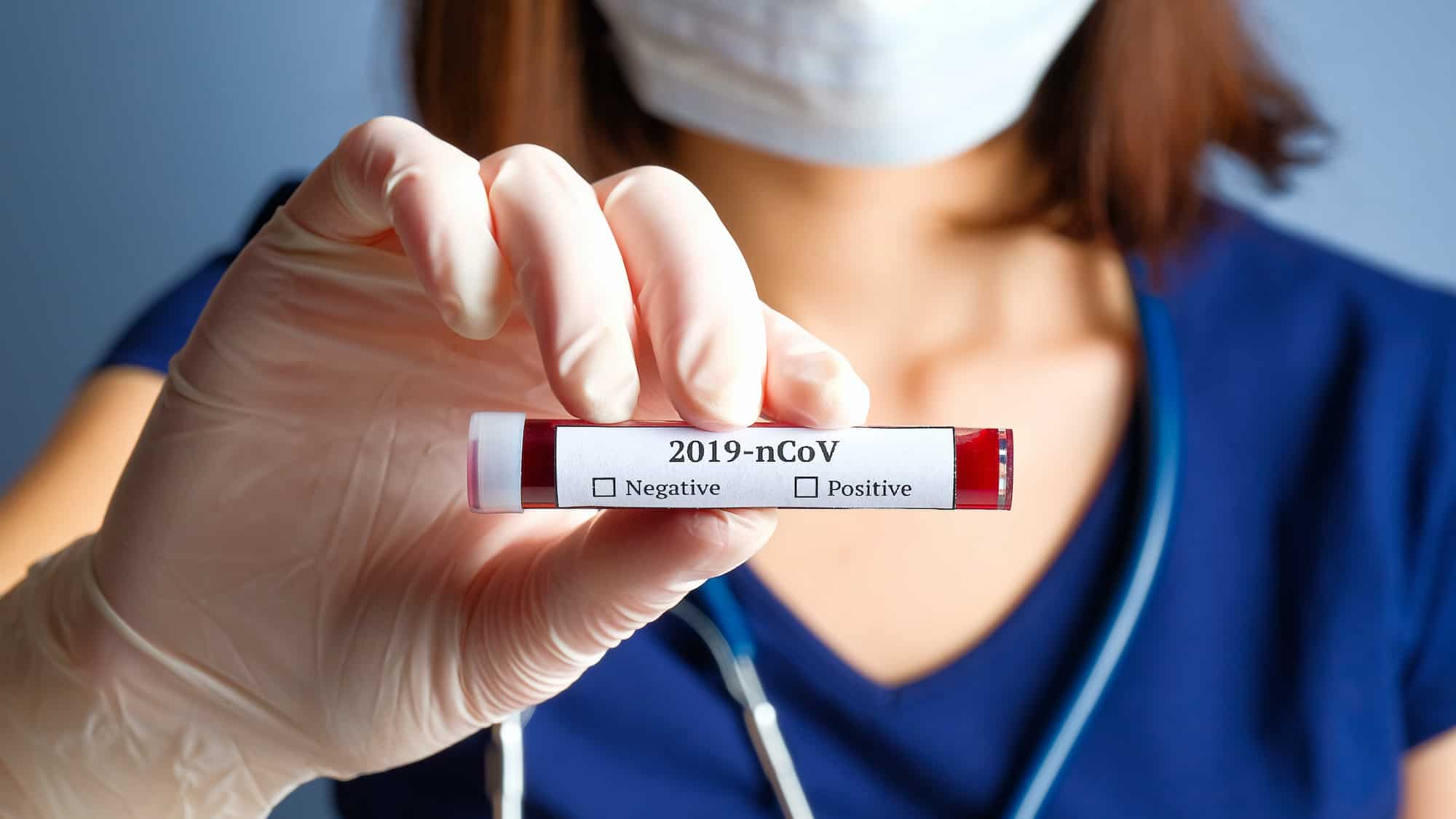 Nurse holding covid-19 antibody test tube with blood for 2019-nCoV analyz Coronavirus blood test concept